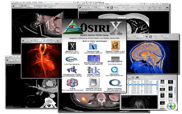 OsiriX Ita